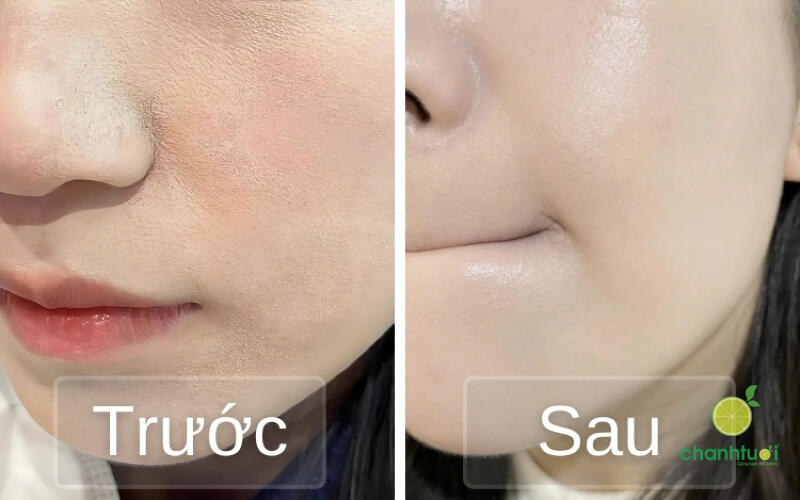 kem nền và kem lót 4