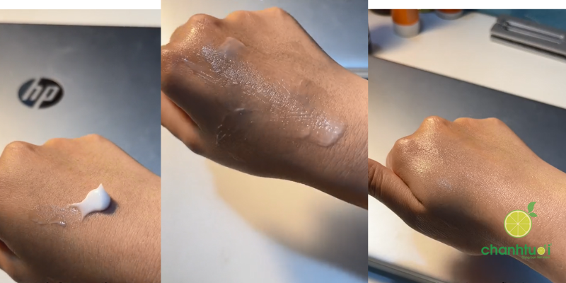 kem trị mụn differin 2