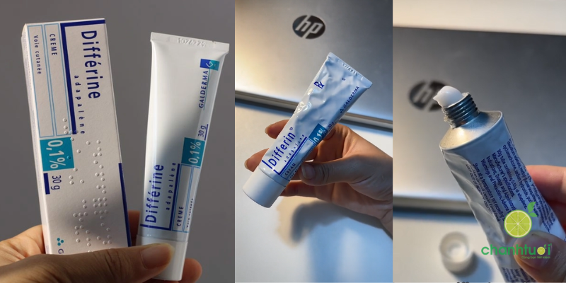 kem trị mụn differin 3