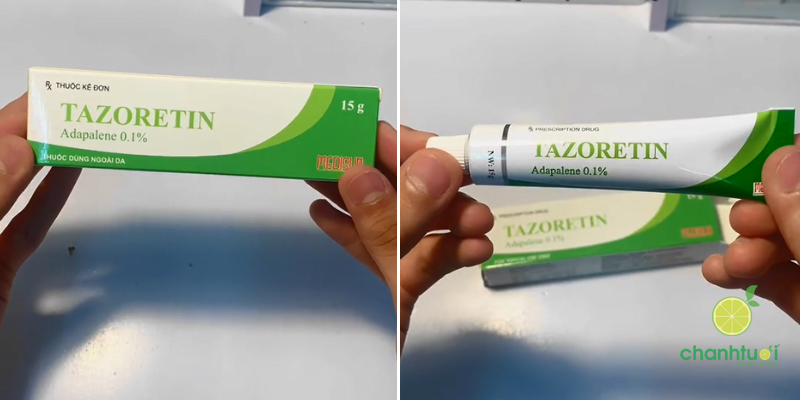 kem trị mụn tazoretin 1