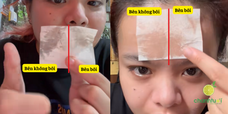 kemd ưỡng floslek kiềm dầu