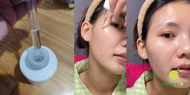 kết cấu bioverse b351