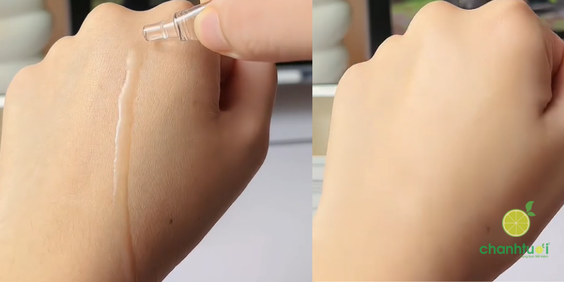 kết cấu thuốc chấm mụn Novolinda