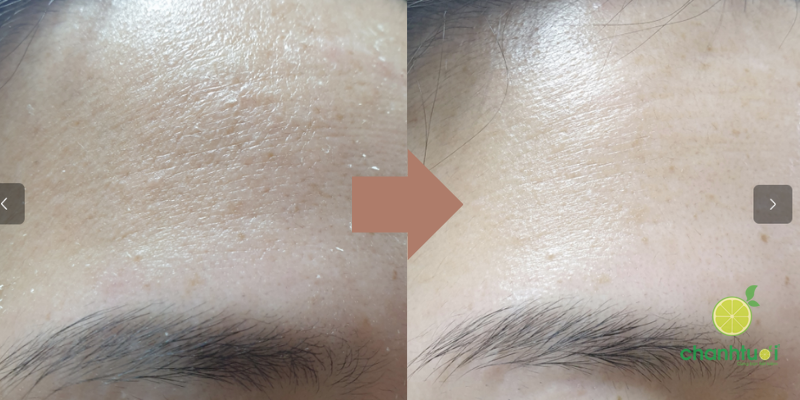 kết quả kem dưỡng Baegayul