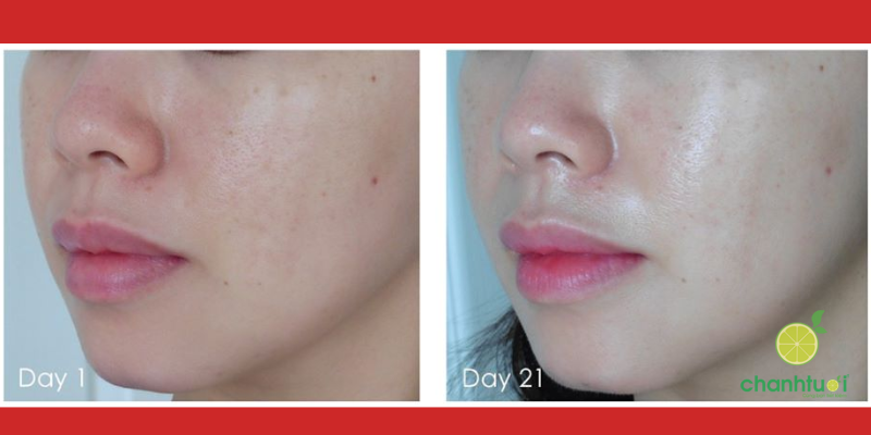 Lotion P50 3