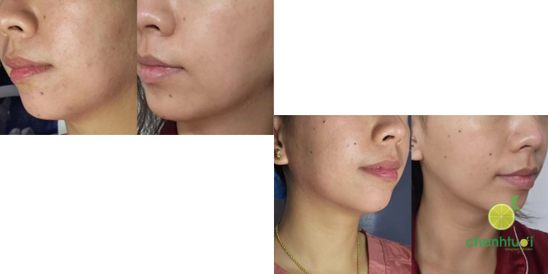 Lotion P50 PIGM 400 4