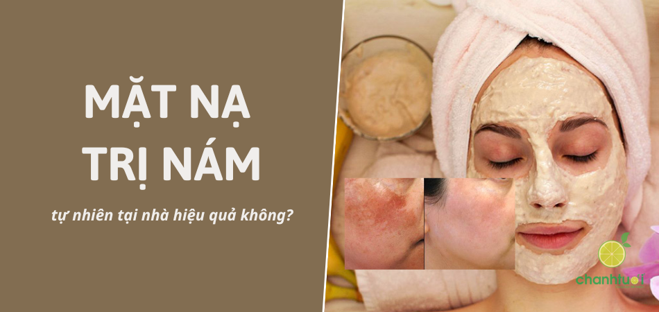 Top 10 mặt nạ trị nám, tàn nhang tự nhiên tại nhà hiệu quả nhất