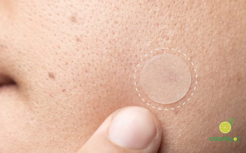 miếng dán mụn pharmacity hiệu quả