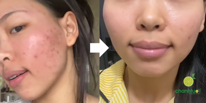 oh oh oatmere kết quả