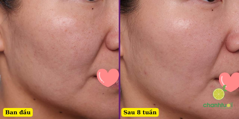 Paula's Choice Clinical 1% Retinol hiệu quả