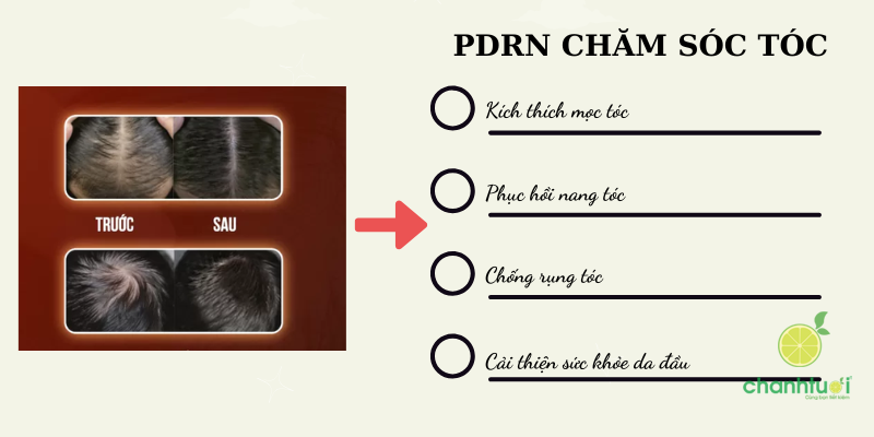pdrn chăm sóc tóc 1