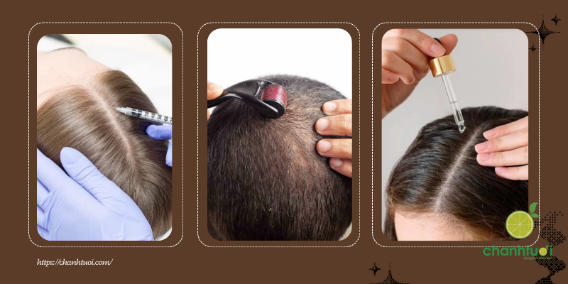 pdrn chăm sóc tóc 2