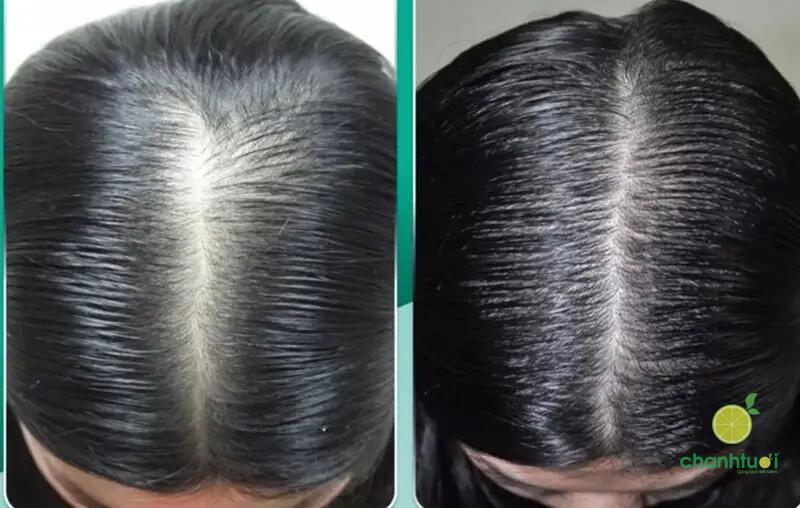 pdrn chăm sóc tóc 3