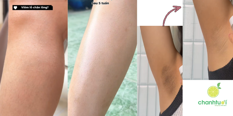 _Peel Glowy BareSoul 2