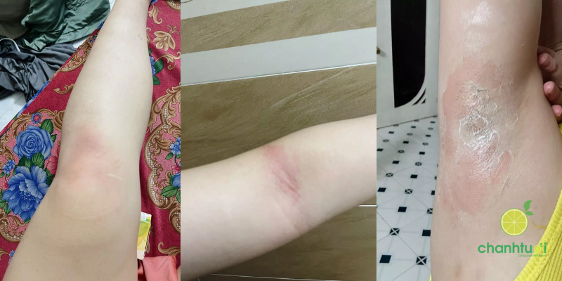 Peel Glowy BareSoul 8