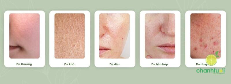 phân loại kem dưỡng da theo loại da