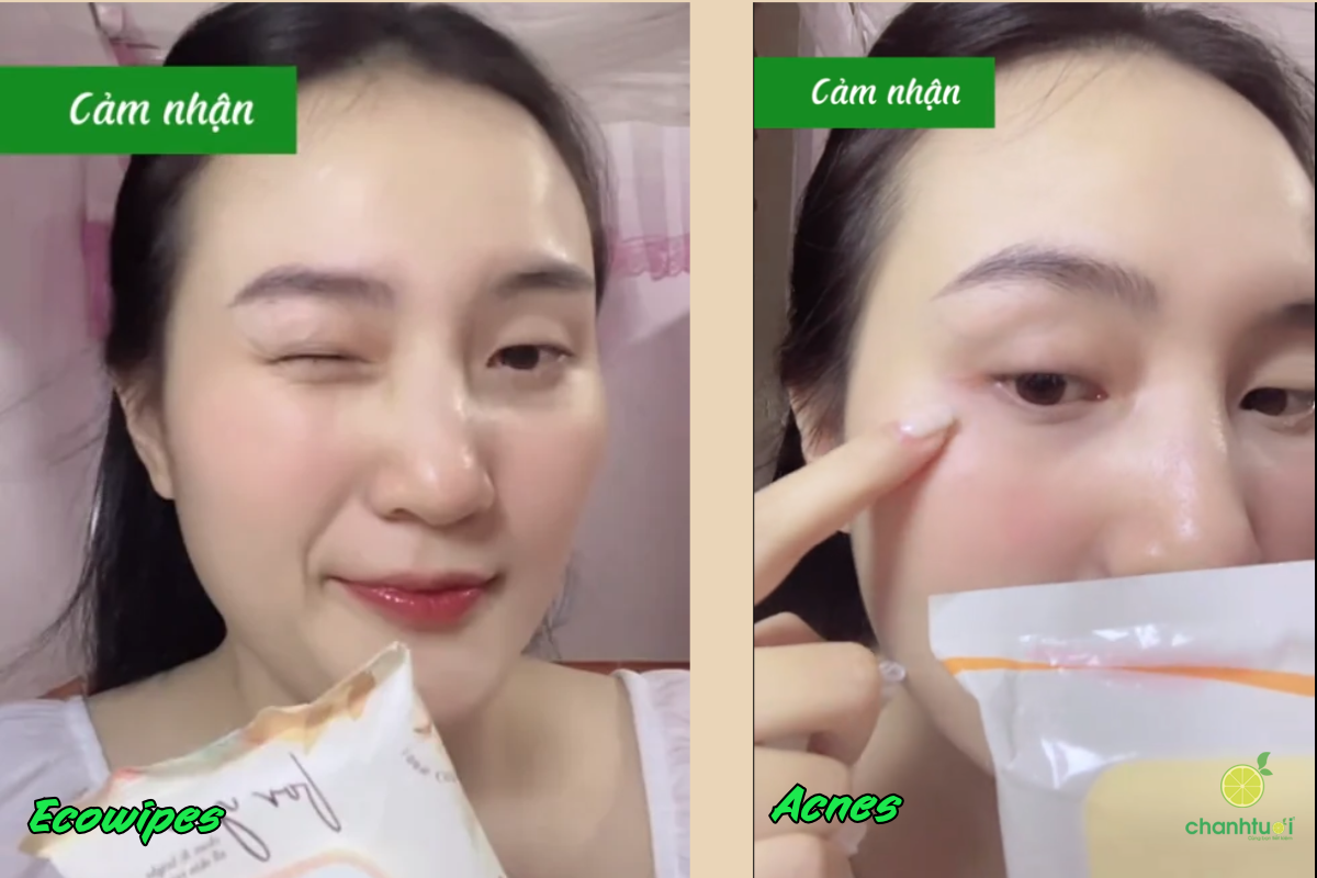 review KHĂN ƯỚT TẨY TRANG 5