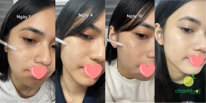 Review Serum Angel’s Liquid 7Day Glutathione 700 3