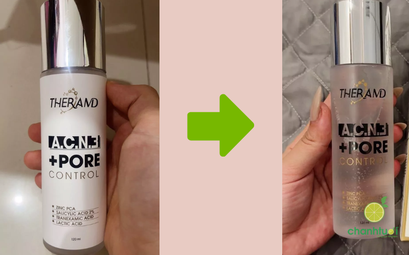 review Theramd acn 3 pore control 4