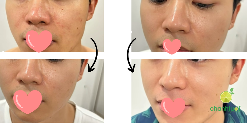 serum chống lão hóa estee lauder hiệu quả 2-1