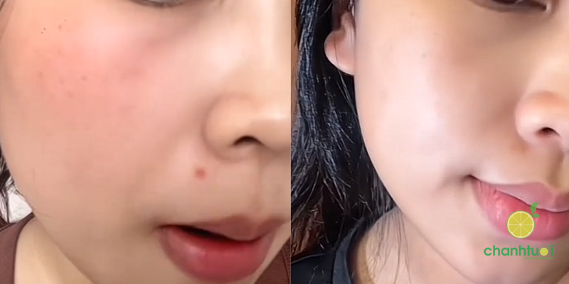 Serum LaCabine 2% Prebiotic hiệu quả