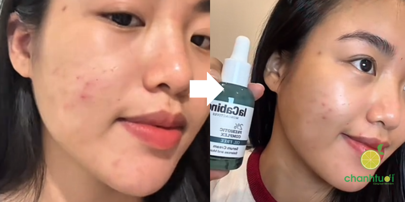 Serum LaCabine 2% Prebiotic trải nghiệm