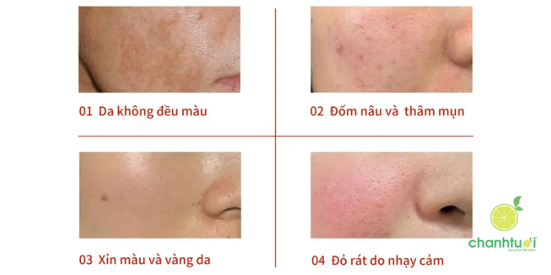 serum Namerbal tảo đỏ 5
