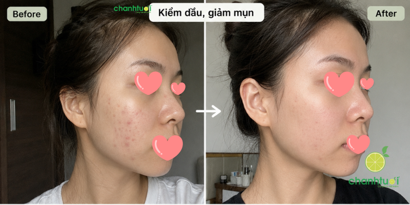 Serum pharmaform aze lift hiệu quả 1