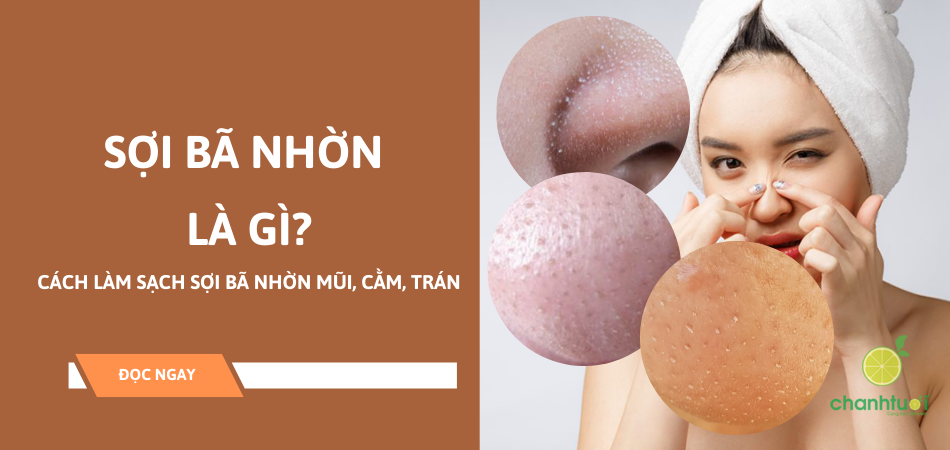 Sự thật về sợi bã nhờn và cách xử lý đúng từ chuyên gia da liễu!