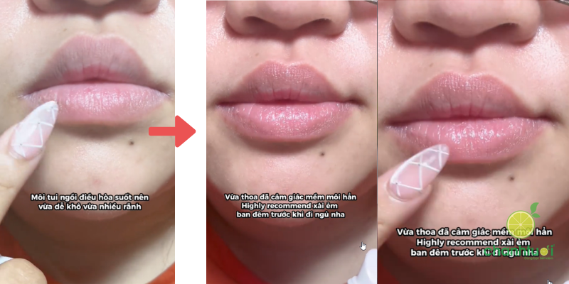 son dưỡng fixderma lip balm hiệu quả