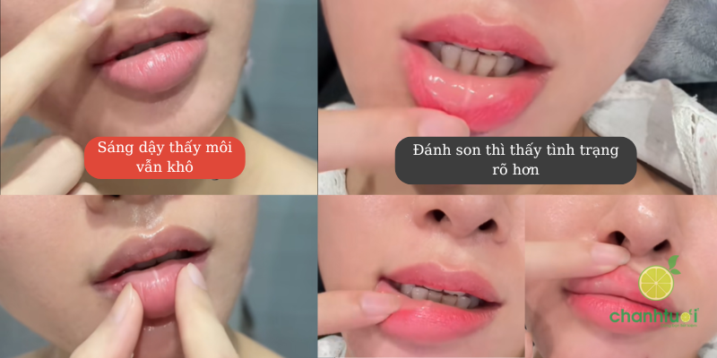 son dưỡng vô cùng tận 3