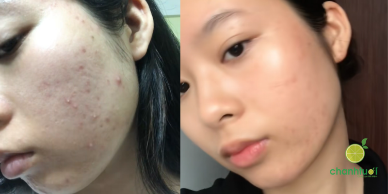 Sữa Rửa Mặt Bioverse AHA BHA hiệu quả