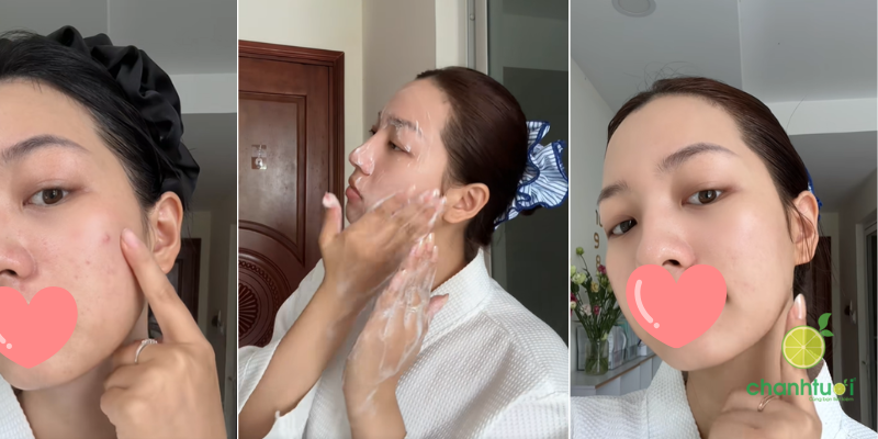 Sữa rửa mặt CeraVe Blemish Control Cleanser trải nghiệm