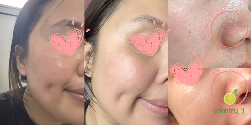 sữa rửa mặt Dermacos 9