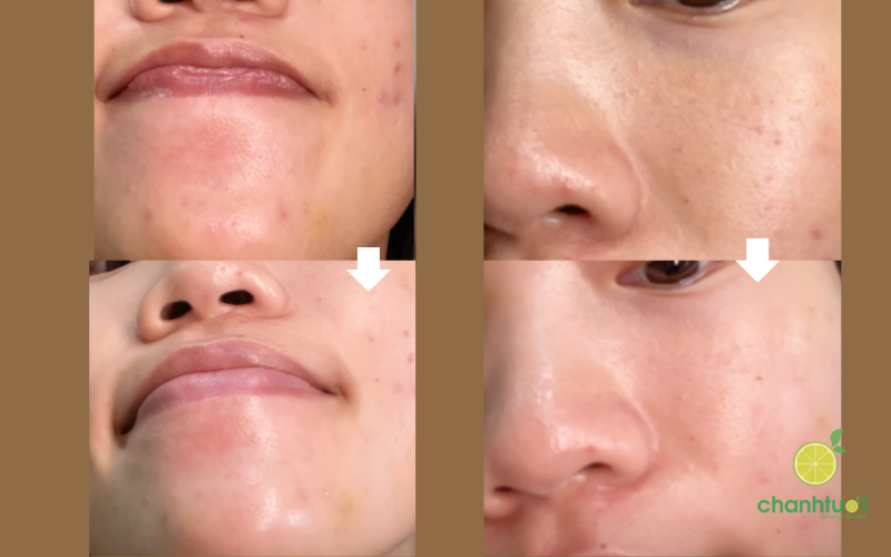 tẩy tế bào chết Paula's Choice Skin Perfecting 6% Mandelic Acid 8