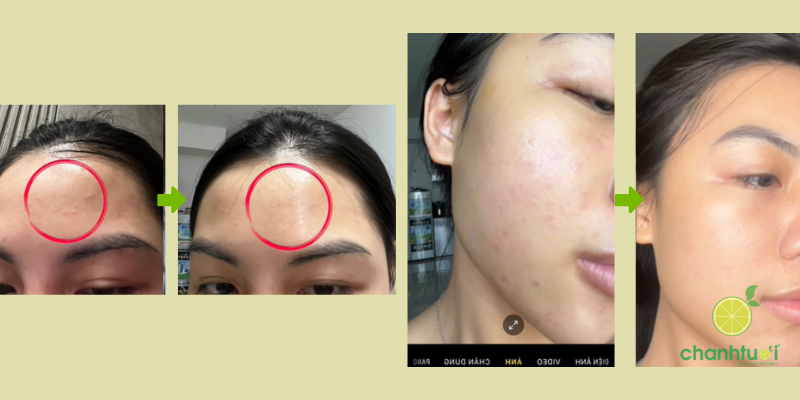 Theramid Copper Peptide hiệu quả