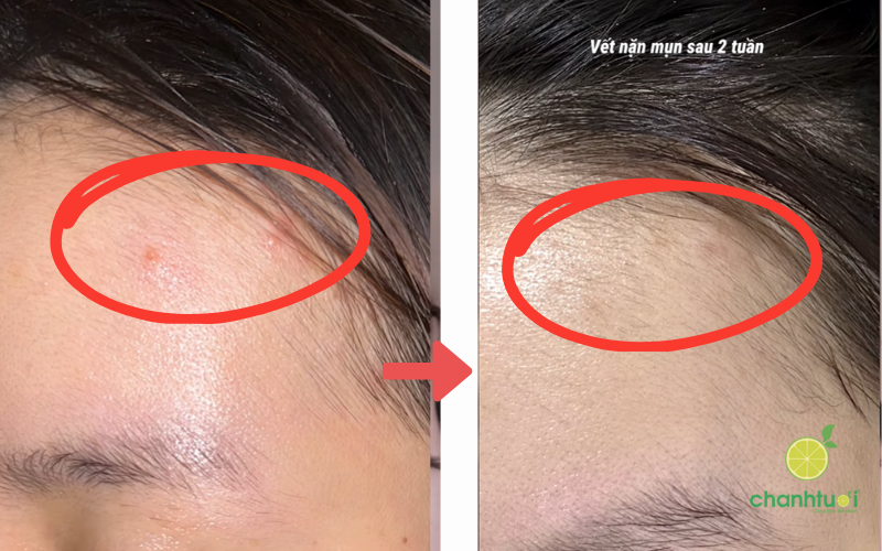 Tinh chất BEPLAIN PDRN Rau Má 02