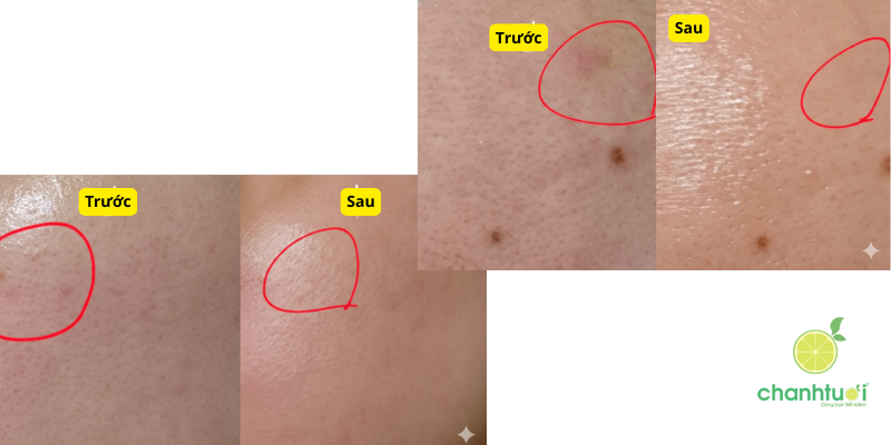 Tinh Chất Rau Má Elravie hiệu quả (1)