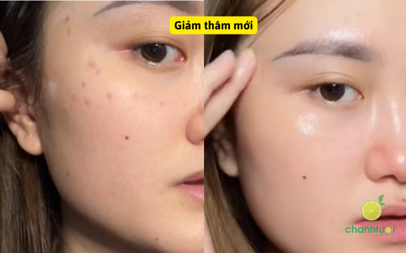 trải nghiệm DrCeutics Alpha Arbutin 5% và Kojic Dipalmitate 2