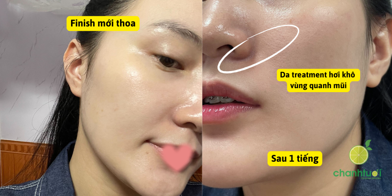 trải nghiệm kem chống nắng Cell Fusion C cho da nhạy cảm