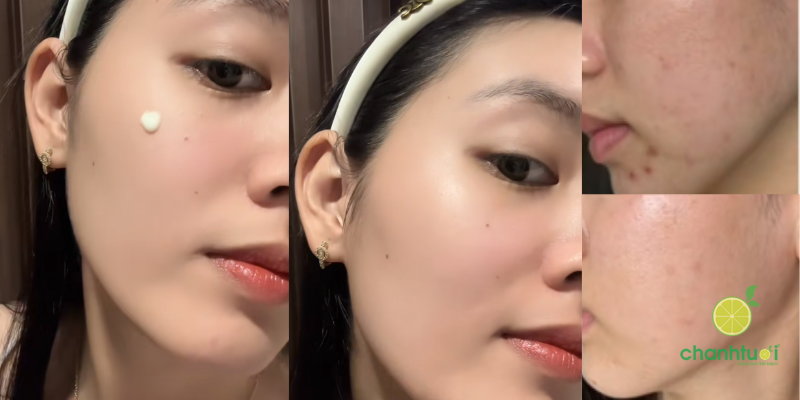 trải nghiệm Retinol Biotrade