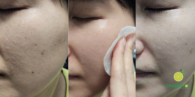 trải nghiệm SODOWE SULFUR PAD (1)