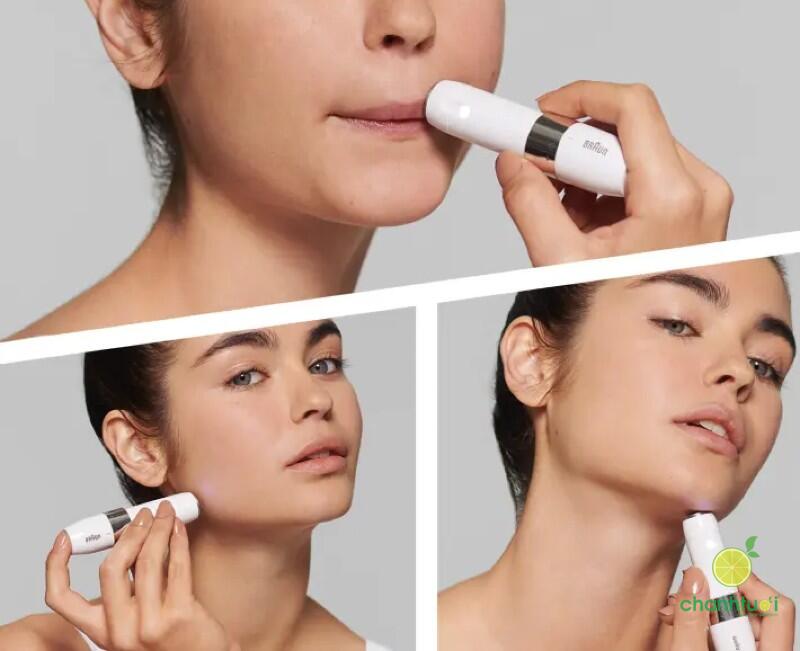 Triệt lông mặt 4