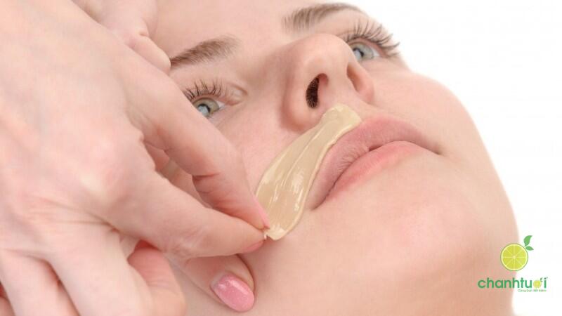 Triệt lông mặt 5