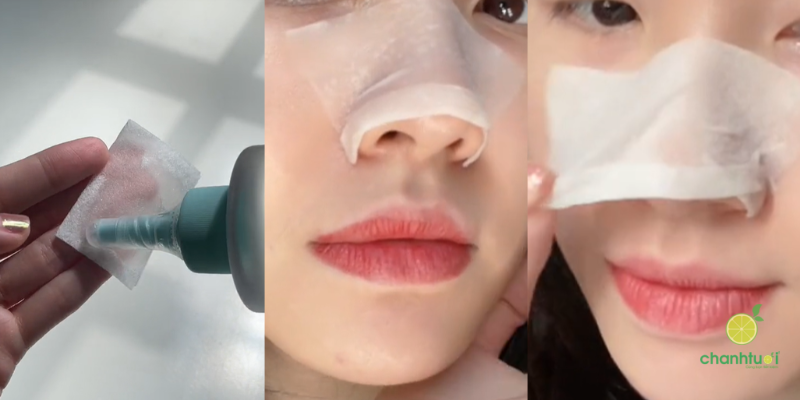 ủ mụn ilso 5