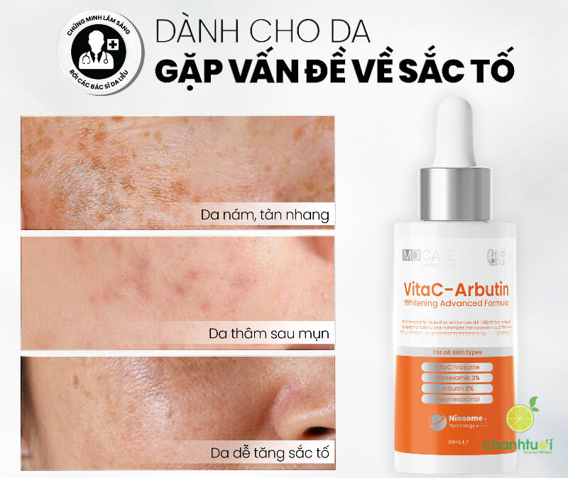 VitaC-Arbutin Serum – Whitening Advanced Formula 5