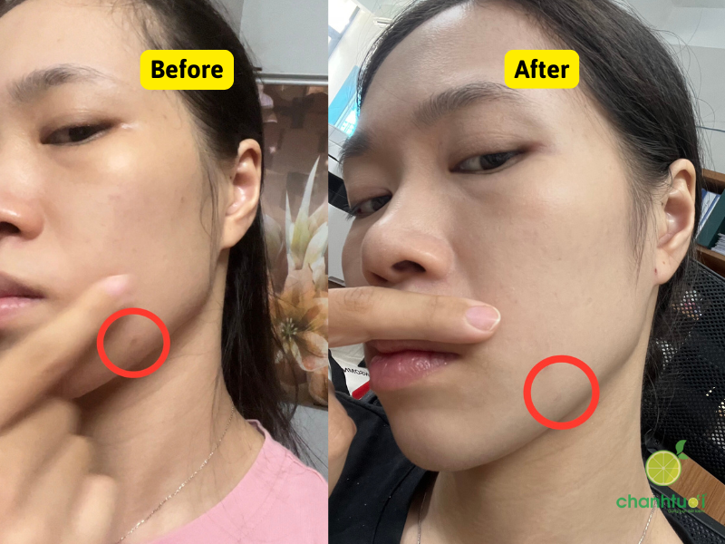 Vitapair C Nature Republic dưỡng sáng