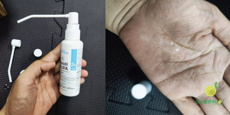 XỊT MỌC TÓC MINOXIDIL kết cấu