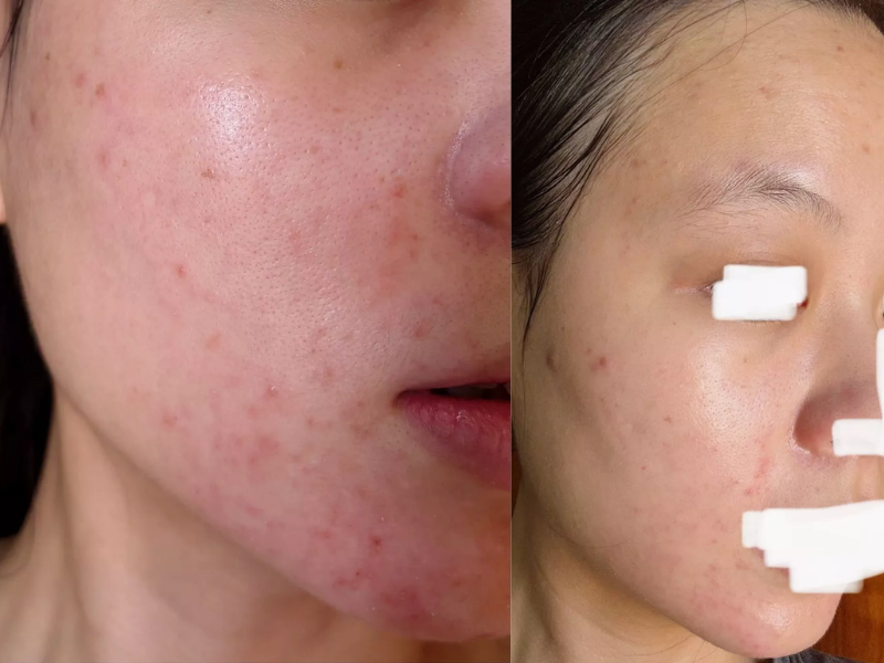 Serum Probiotic Zakka (1)