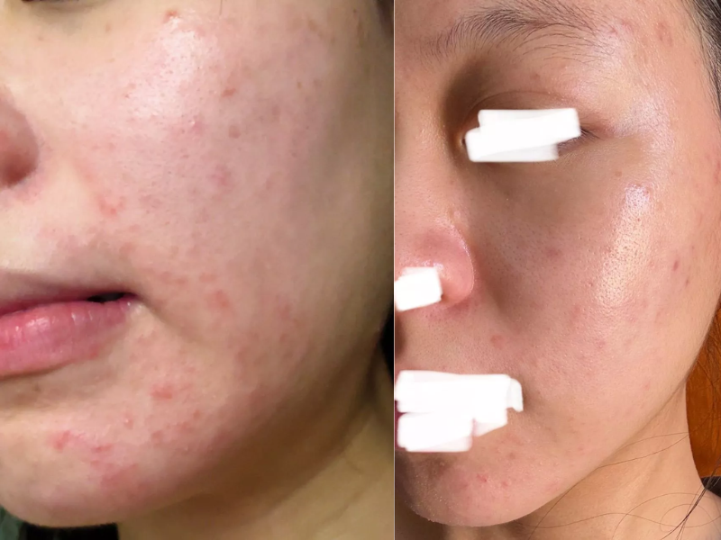 Serum Probiotic Zakka